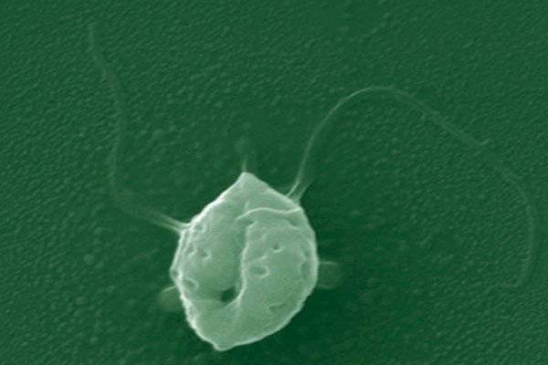 Зооспорангий фитофторы под микроскопом